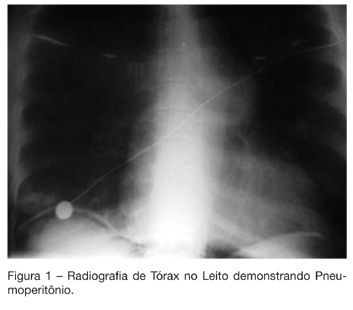 Ruptura gástrica por reanimação cardiopulmonar: relato de caso