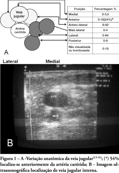 Ultrasound-guided venous cannullation in critical care unit