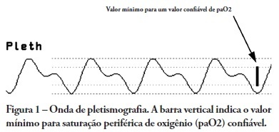 Comparação entre as variações respiratórias da amplitude de onda pletismográfica da oximetria de pulso e do pulso arterial em pacientes com e sem uso de norepinefrina