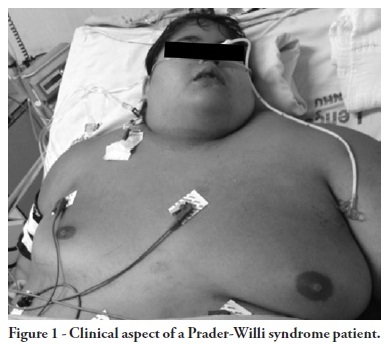 Multidisciplinary care in the intensive care unit for a patient with Prader-Willi syndrome: a dental approach