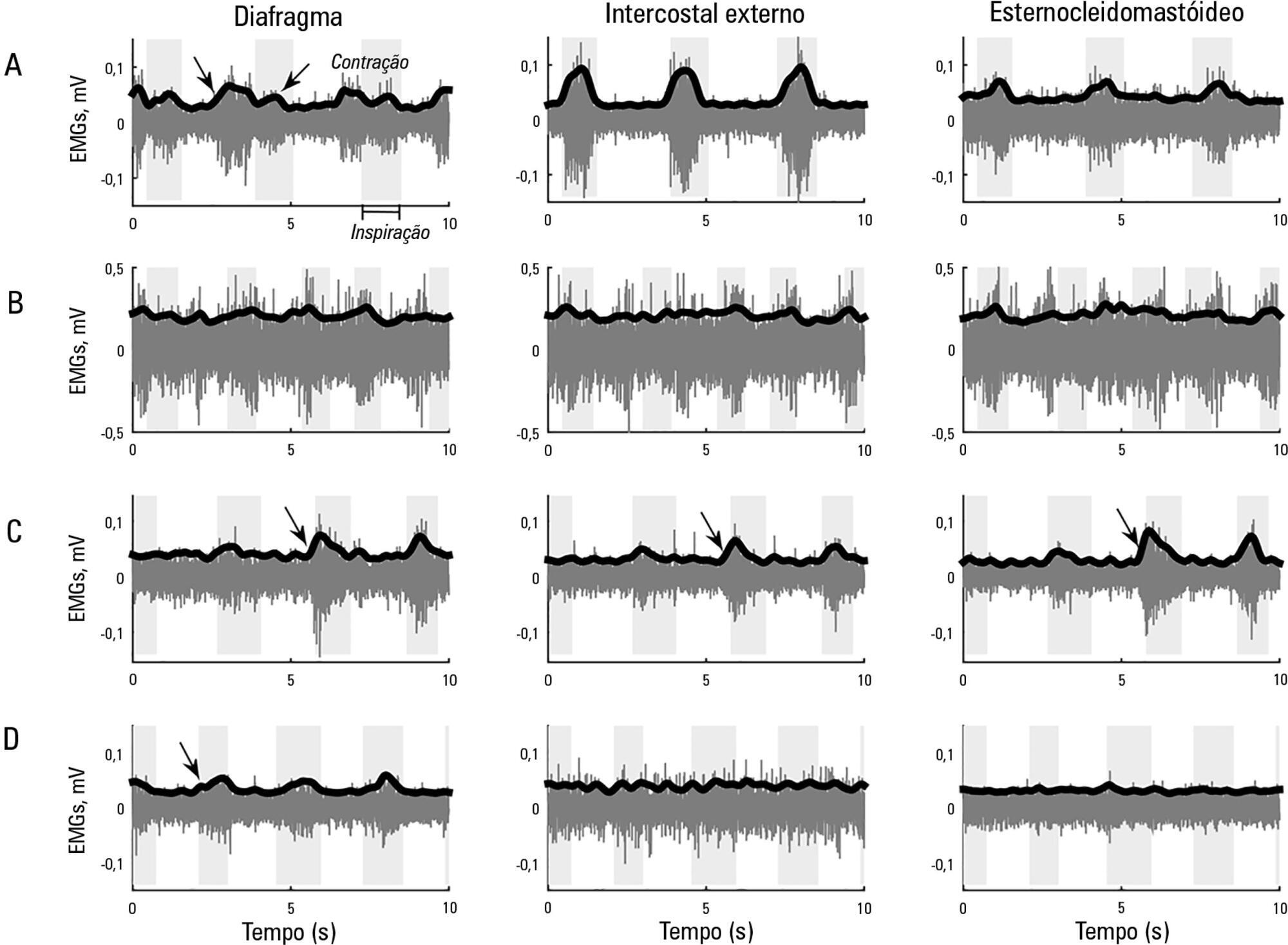 Potential clinical application of surface electromyography as indicator of neuromuscular recovery during weaning tests after organophosphate poisoning
