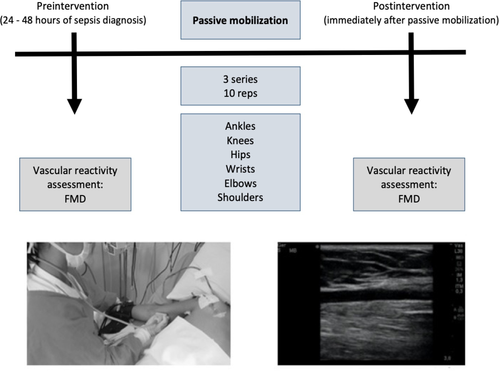 Early passive mobilization increases vascular reactivity response in critical patients with sepsis: a quasi-experimental study